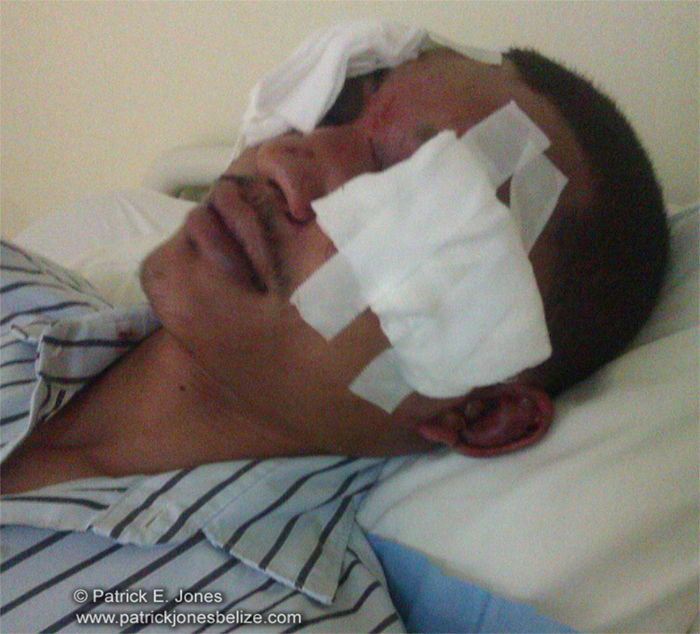 Jonathan Chavez (Attack victim)